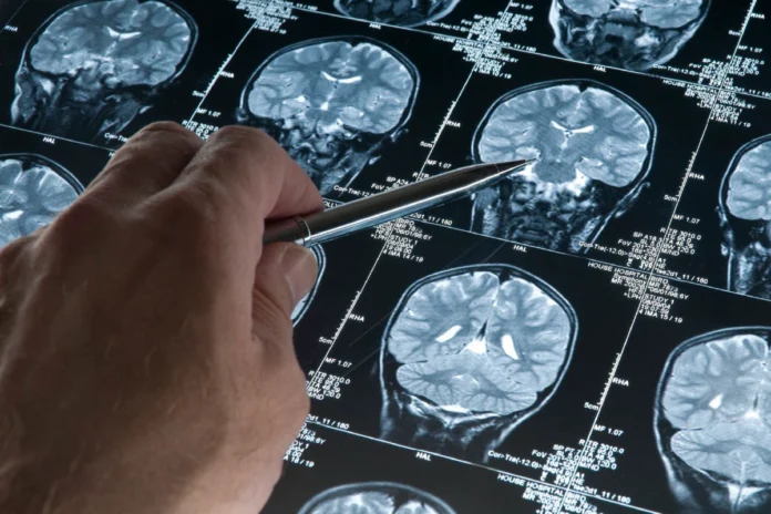Investigación científica sobre proteína PTP1B y Alzheimer en laboratorio de Nueva York